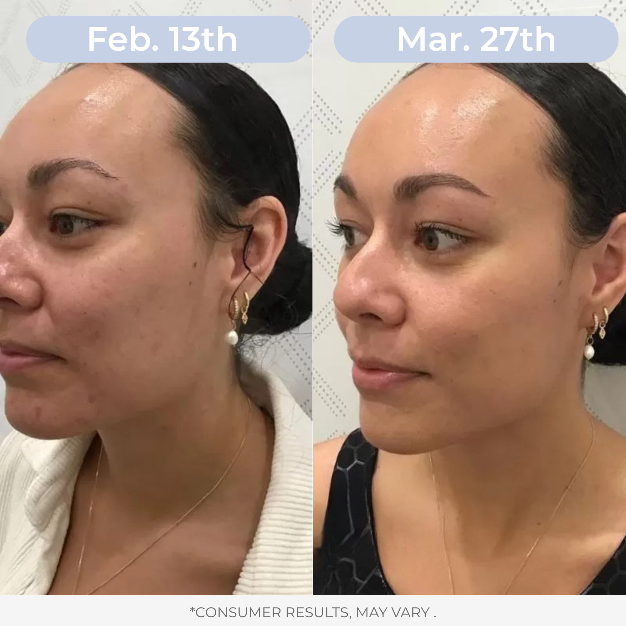 Liposomal Glutathione