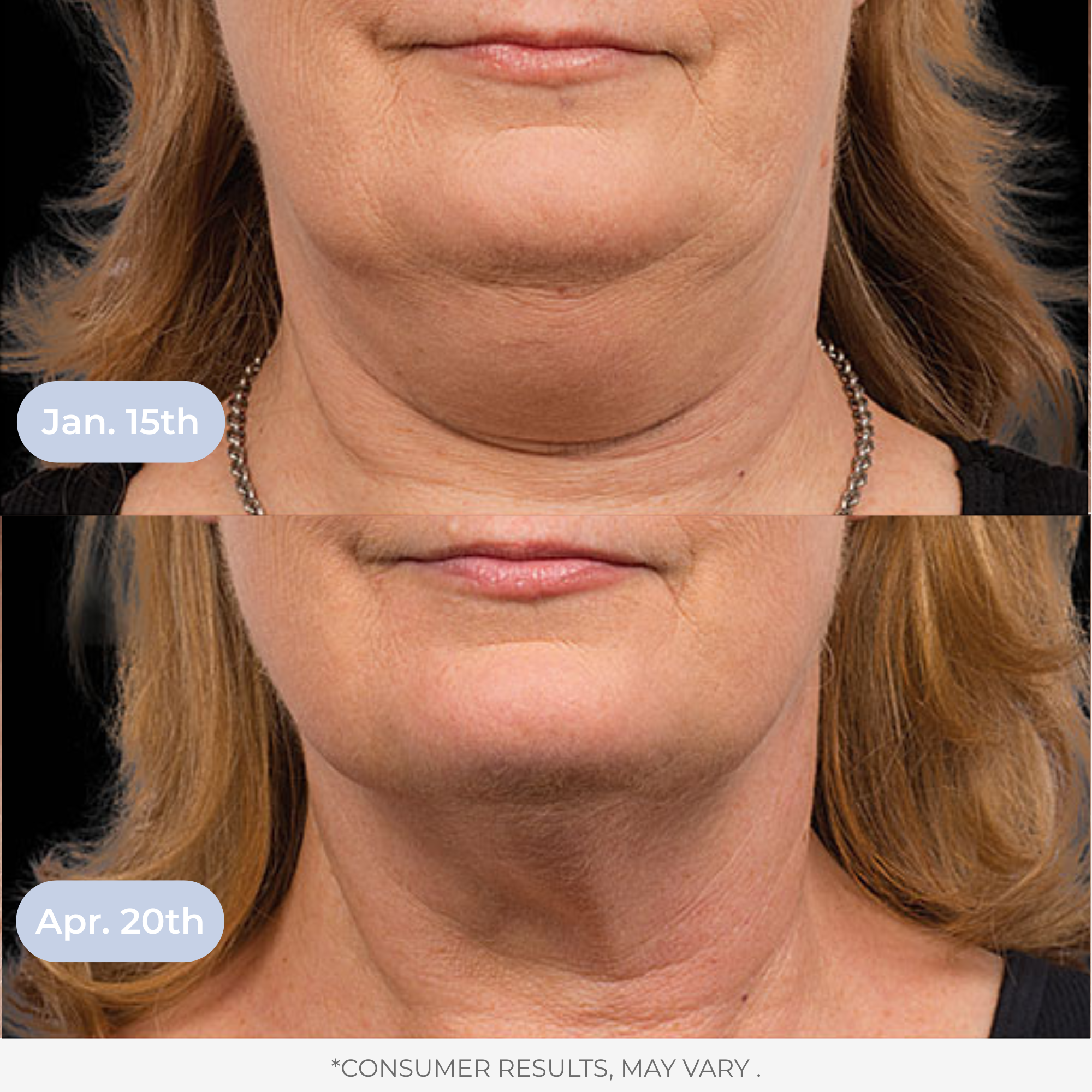 Liposomal Glutathione