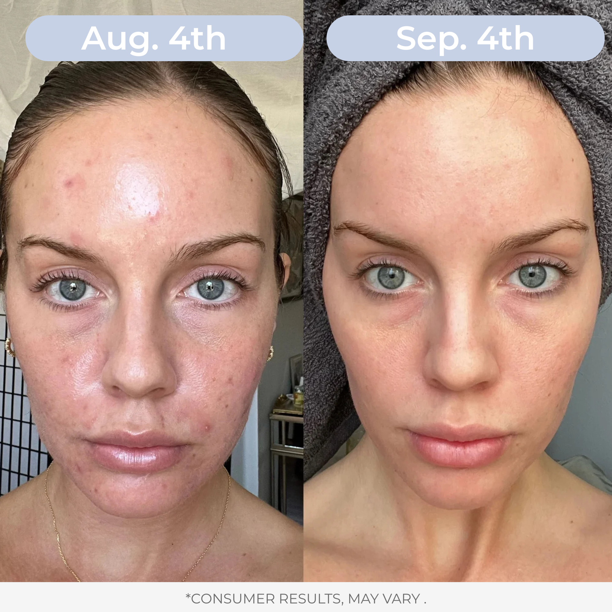 Liposomal Glutathione