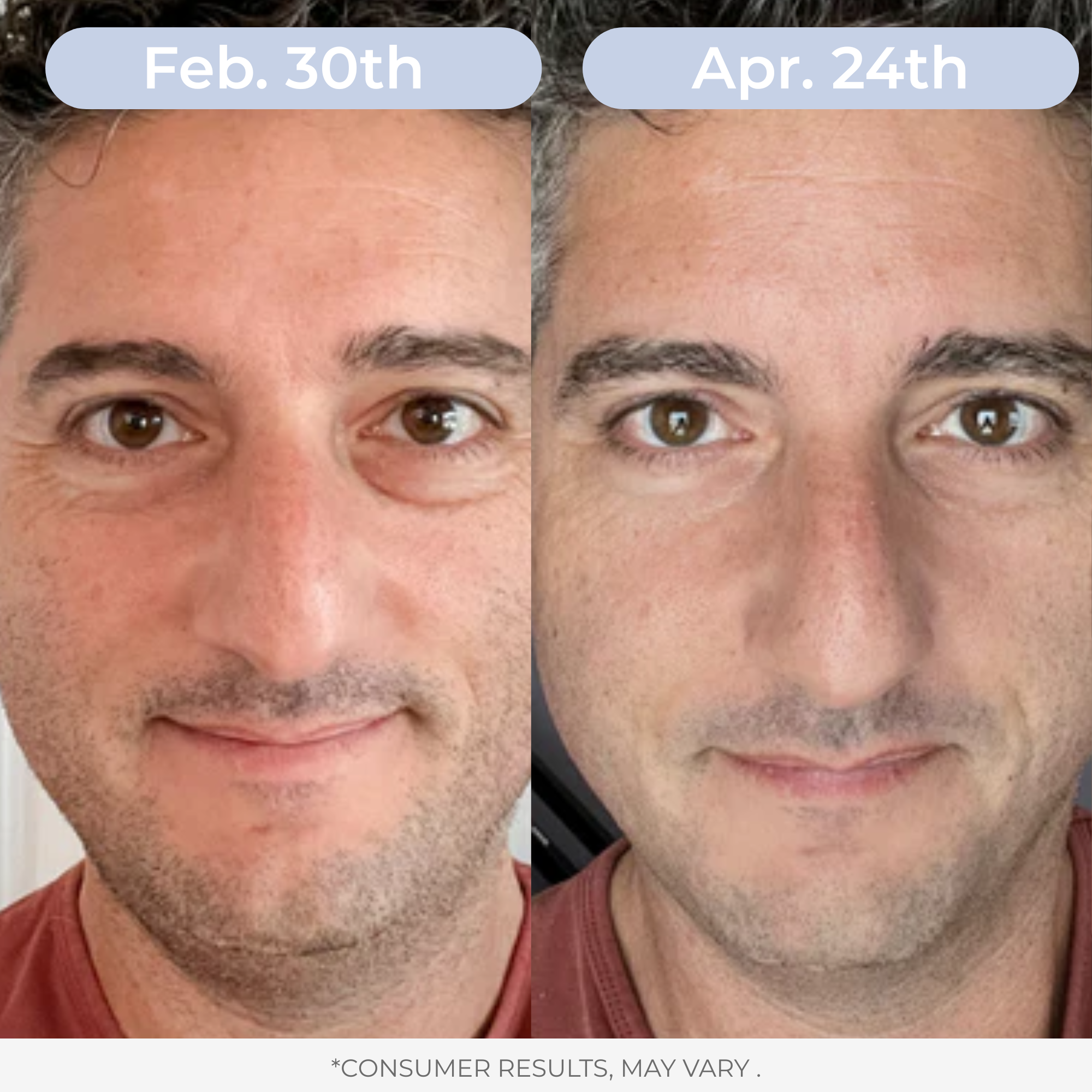 Liposomal Glutathione