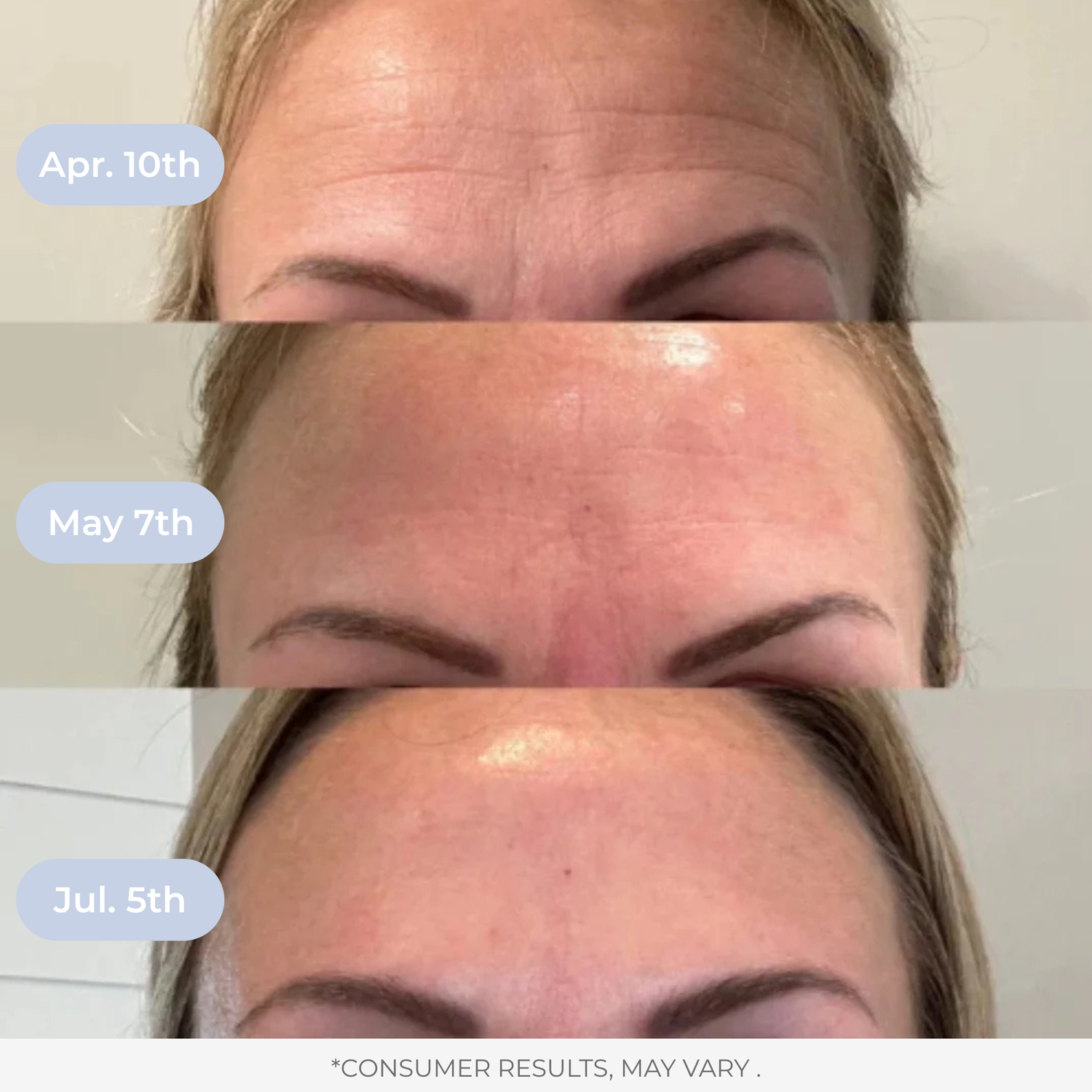 Liposomal Glutathione