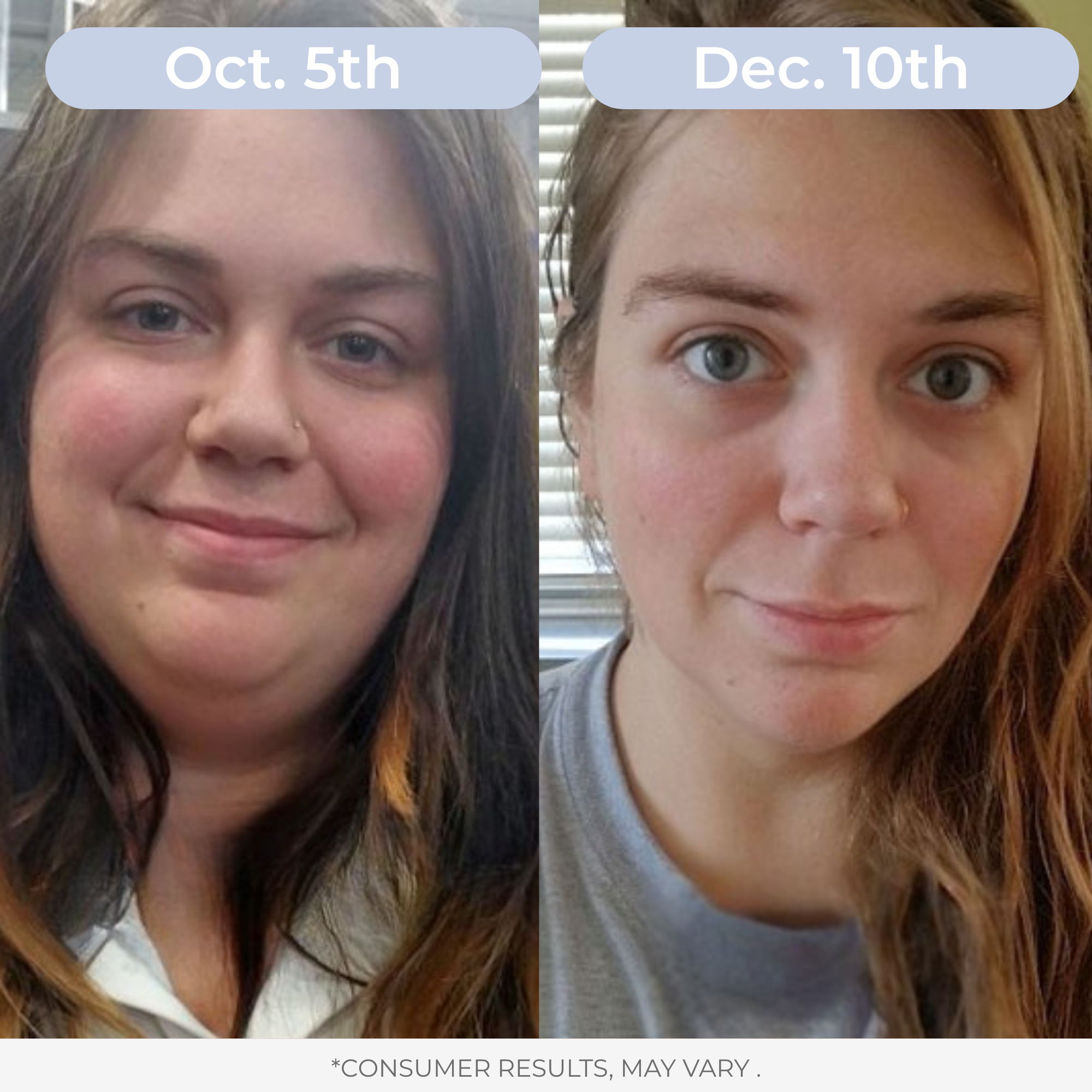 Liposomal Glutathione