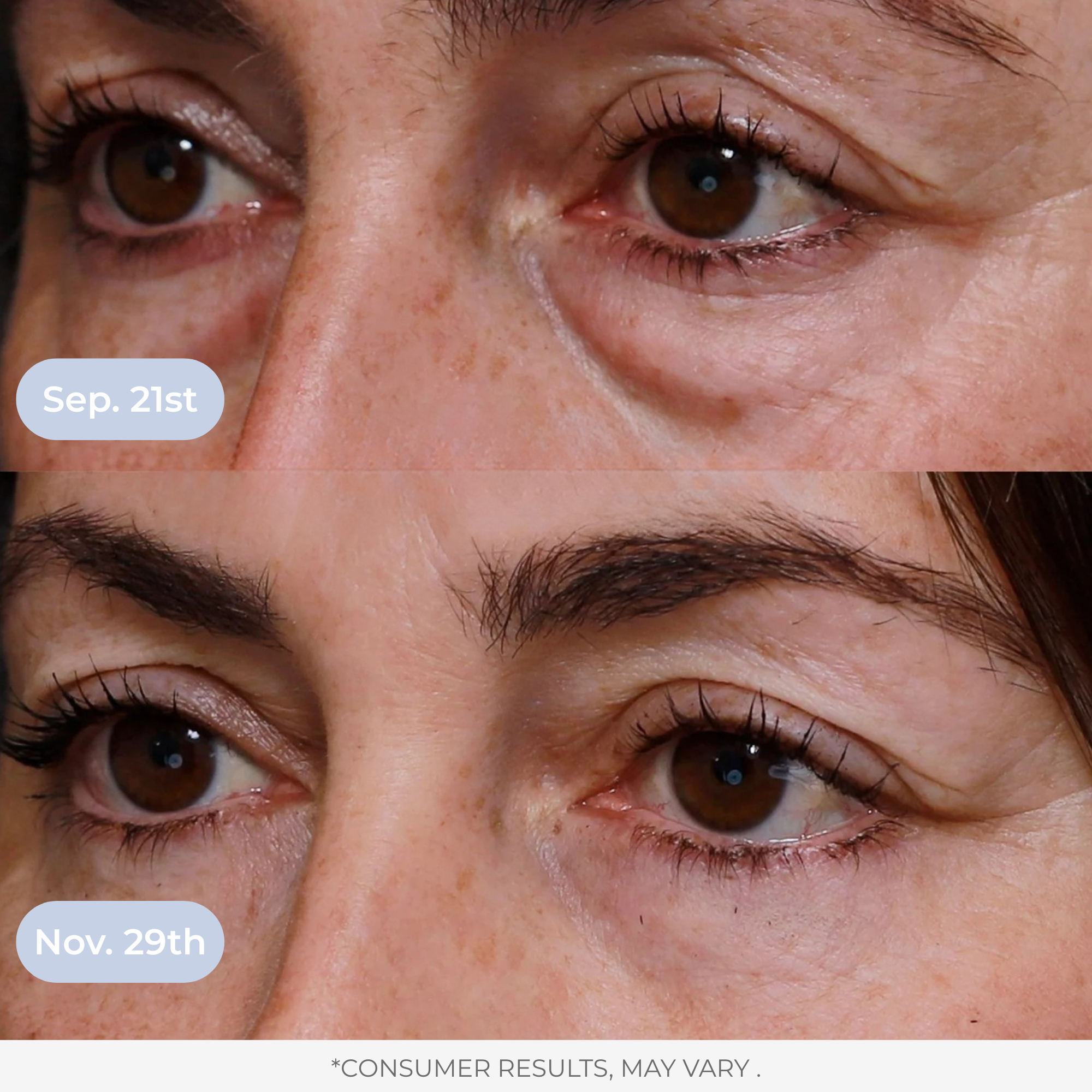 Liposomal Glutathione