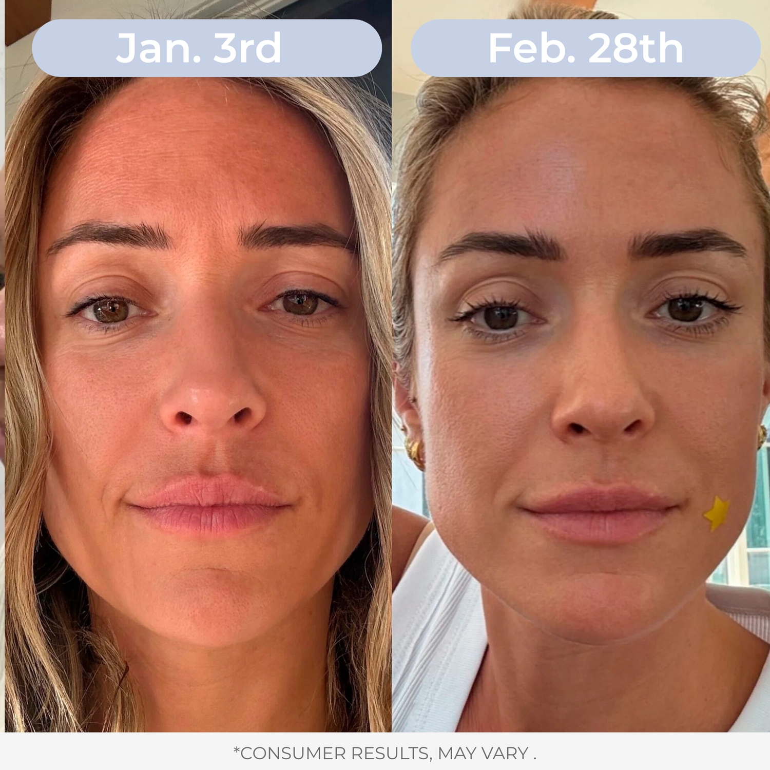 Liposomal Glutathione