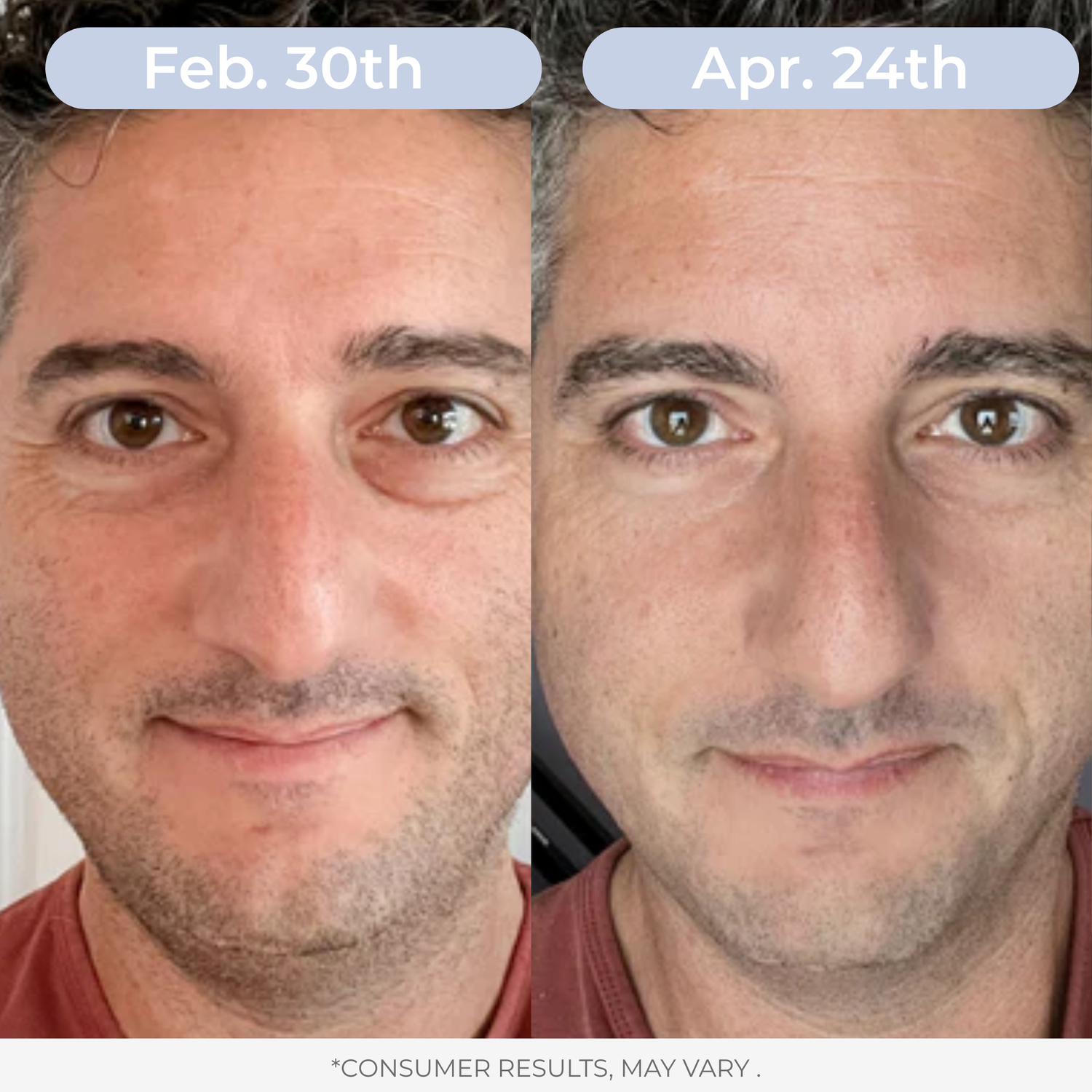 Liposomal Glutathione